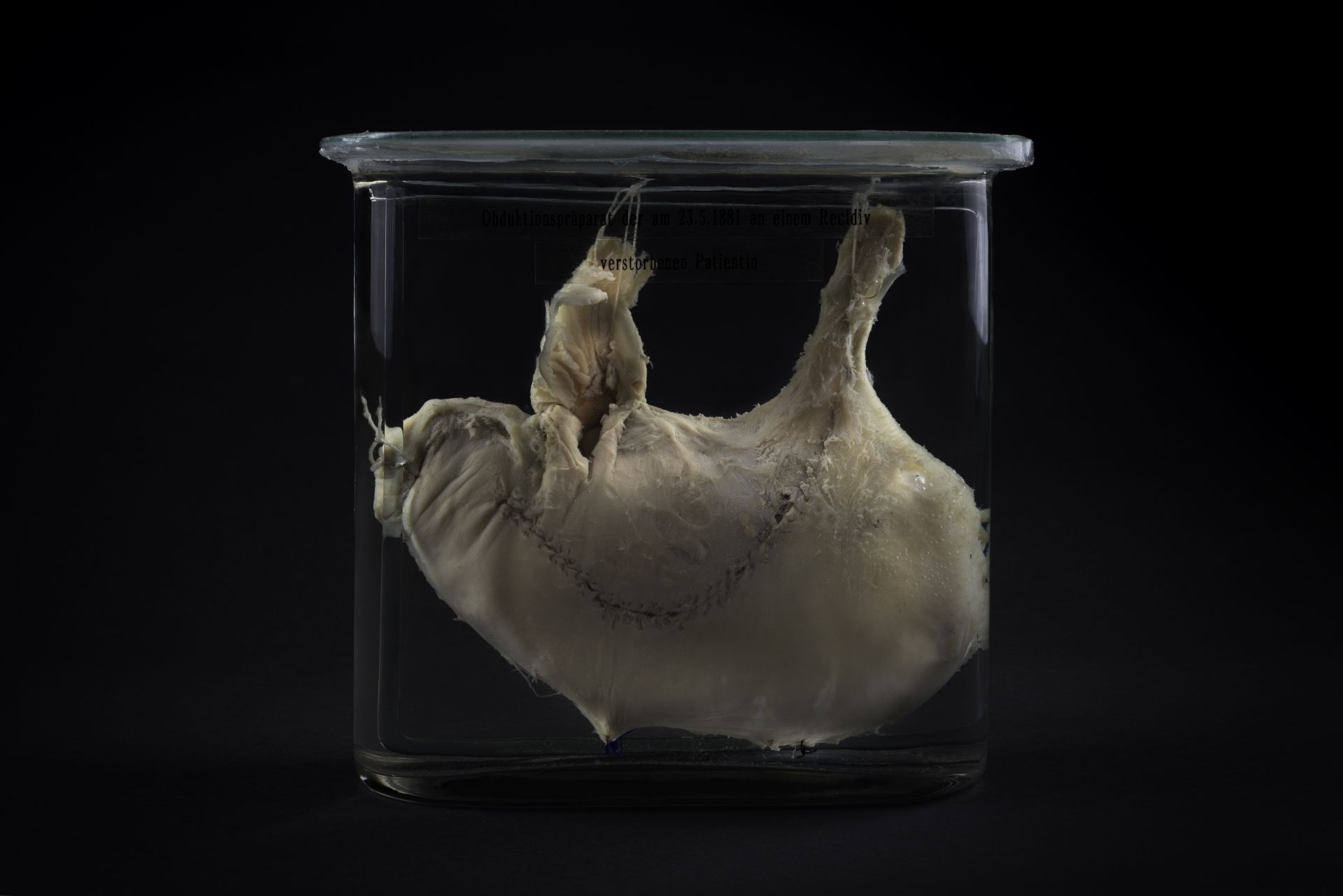Dried, sewn, and preserved tissue in a glass container against a black background